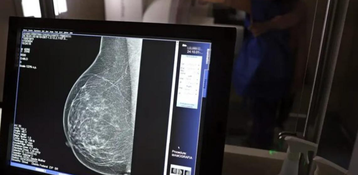 Prevenção e detecção precoce são destaques no Outubro Rosa deste ano