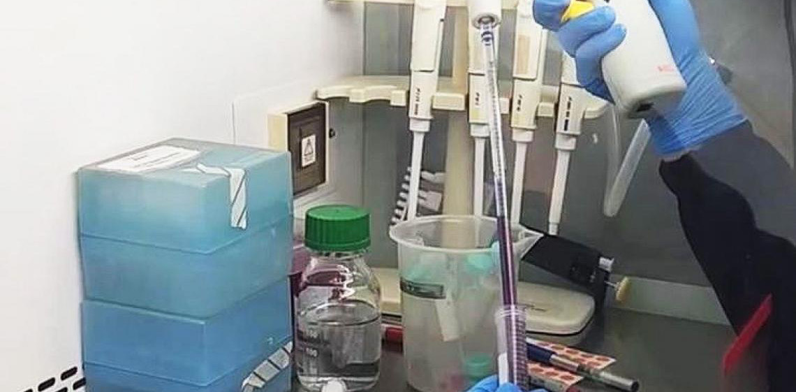 Câncer de mama: Com apoio da FAPDF, pesquisa investiga novos caminhos para conter a metástase