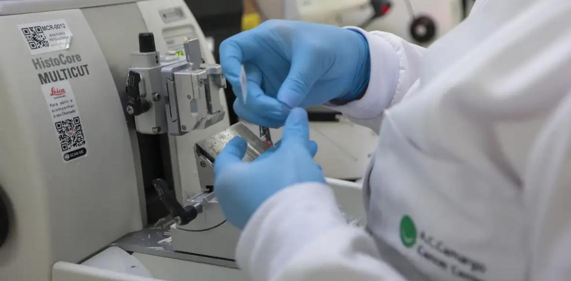 Cura de pacientes com câncer de próstata pode chegar a até 98%